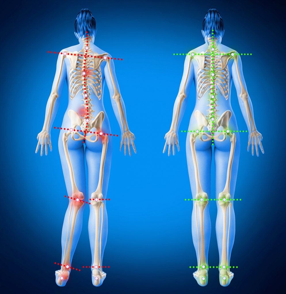 Définition, symptômes et diagnostic de l'arthrose du genou